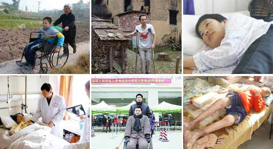 郑州痛风风湿病医院强直性脊柱炎导致瘫痪使得他们的生活处处不便.jpg