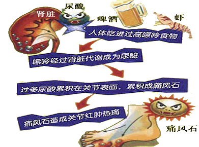 郑州痛风风湿病医院高嘌呤食物容易导致痛风急性发作.gif